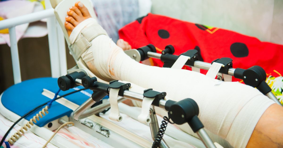 An injured leg wrapped up while in a hospital bed.