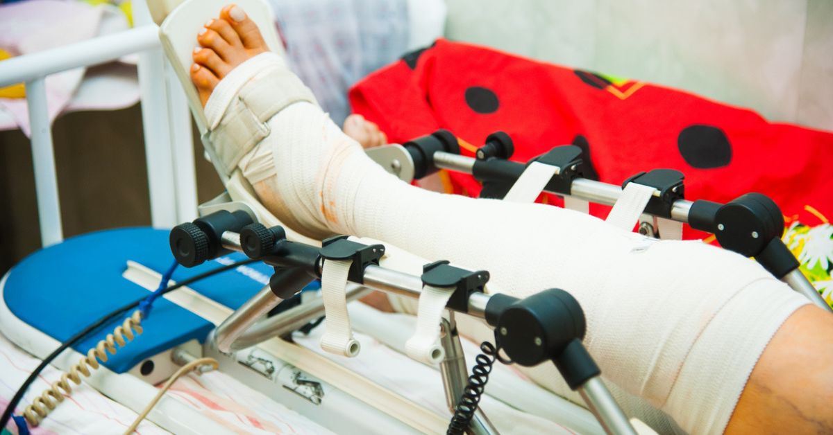 An injured leg wrapped up while in a hospital bed.