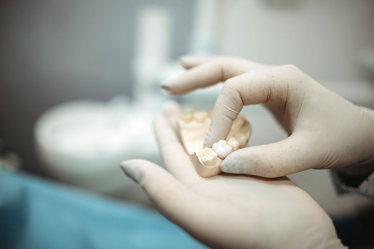 Dentist wearing gloves holding a mouth mold